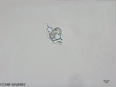 phyto/Brazilian_Nordeste/AtoldasRocas_station22/ABRACOS1 October 2015/Histioneis hyalina (Snap-2098)-2(copy)_thumb.jpg